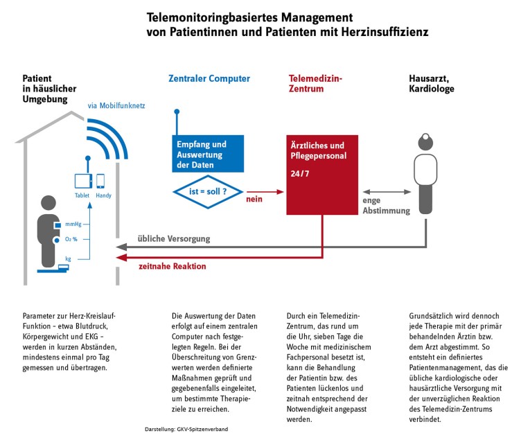 Telemonitoringbasiertes Management von Patientinnen und Patienten mit Herzinsuffizienz